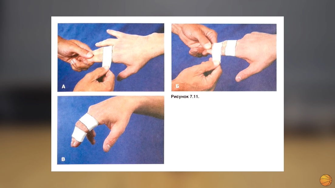 Обмотали два пальца для баскетбола 